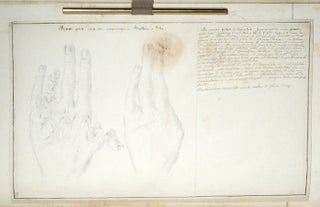 Opérations chirurgicales [Manuscript on The Hand]